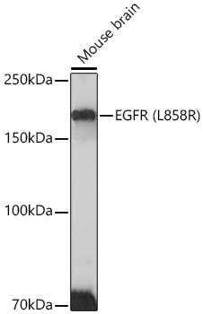 Western blot analysis of lysates from Mouse brain , using EGFR (L858R) Rabbit mAb at 1:500 dilution.|Secondary antibody: HRP-conjugated Goat anti-Rabbit IgG (H+L) at 1:10000 dilution.|Lysates/proteins: 25μg per lane.|Blocking buffer: 3% nonfat dry milk in TBST.|Detection: ECL Enhanced Kit.|Exposure time: 3min.