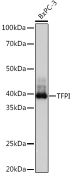 Western blot analysis of lysates from BxPC-3 cells, using TFPI Rabbit mAb at 1:1000 dilution.|Secondary antibody: HRP-conjugated Goat anti-Rabbit IgG (H+L) at 1:10000 dilution.|Lysates/proteins: 25μg per lane.|Blocking buffer: 3% nonfat dry milk in TBST.|Detection: ECL Basic Kit.|Exposure time: 10s.