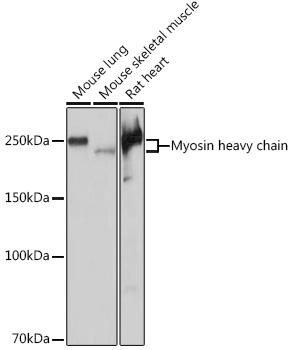 Western blot analysis of various lysates using Myosin heavy chain Rabbit mAb at 1:1000 dilution.|Secondary antibody: HRP-conjugated Goat anti-Rabbit IgG (H+L) at 1:10000 dilution.|Lysates/proteins: 25μg per lane.|Blocking buffer: 3% nonfat dry milk in TBST.|Detection: ECL Basic Kit.|Exposure time: 1s.