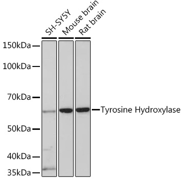 Western blot analysis of various lysates using Tyrosine Hydroxylase Rabbit mAb at 1:1000 dilution.|Secondary antibody: HRP-conjugated Goat anti-Rabbit IgG (H+L) at 1:10000 dilution.|Lysates/proteins: 25μg per lane.|Blocking buffer: 3% nonfat dry milk in TBST.|Detection: ECL Basic Kit.|Exposure time: 3min.