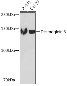 Western blot analysis of various lysates using Desmoglein 3 Rabbit mAb at 1:1000 dilution.|Secondary antibody: HRP-conjugated Goat anti-Rabbit IgG (H+L) at 1:10000 dilution.|Lysates/proteins: 25μg per lane.|Blocking buffer: 3% nonfat dry milk in TBST.|Detection: ECL Enhanced Kit.|Exposure time: 3min.