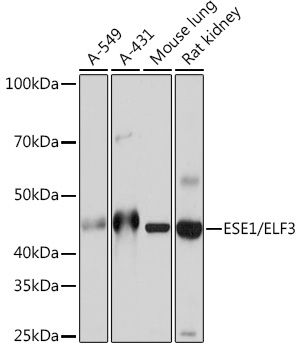 Western blot analysis of various lysates using ESE1/ELF3 Rabbit mAb at 1:1000 dilution.|Secondary antibody: HRP-conjugated Goat anti-Rabbit IgG (H+L) at 1:10000 dilution.|Lysates/proteins: 25μg per lane.|Blocking buffer: 3% nonfat dry milk in TBST.|Detection: ECL Basic Kit.|Exposure time: 10s.
