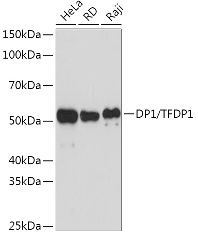 Western blot analysis of various lysates using DP1/TFDP1 Rabbit mAb at 1:1000 dilution.|Secondary antibody: HRP-conjugated Goat anti-Rabbit IgG (H+L) at 1:10000 dilution.|Lysates/proteins: 25μg per lane.|Blocking buffer: 3% nonfat dry milk in TBST.|Detection: ECL Basic Kit.|Exposure time: 60s.