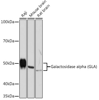 Western blot analysis of various lysates using Galactosidase alpha (GLA) (GLA) Rabbit mAb at 1:1000 dilution.|Secondary antibody: HRP-conjugated Goat anti-Rabbit IgG (H+L) at 1:10000 dilution.|Lysates/proteins: 25μg per lane.|Blocking buffer: 3% nonfat dry milk in TBST.|Detection: ECL Basic Kit.|Exposure time: 3min.