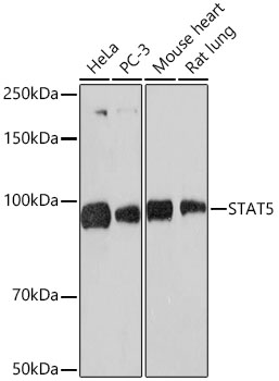 Western blot analysis of various lysates using STAT5 Rabbit mAb at 1:1000 dilution.|Secondary antibody: HRP-conjugated Goat anti-Rabbit IgG (H+L) at 1:10000 dilution.|Lysates/proteins: 25μg per lane.|Blocking buffer: 3% nonfat dry milk in TBST.|Detection: ECL Basic Kit.|Exposure time: 60s.