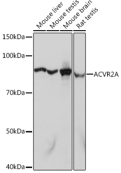 Western blot analysis of various lysates using [KO Validated] ACVR2A Rabbit mAb at 1:1000 dilution.|Secondary antibody: HRP-conjugated Goat anti-Rabbit IgG (H+L) at 1:10000 dilution.|Lysates/proteins: 25μg per lane.|Blocking buffer: 3% nonfat dry milk in TBST.|Detection: ECL Basic Kit.|Exposure time: 1s.