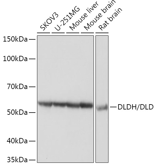 Western blot analysis of various lysates using DLDH/DLD Rabbit mAb at 1:3000 dilution.|Secondary antibody: HRP-conjugated Goat anti-Rabbit IgG (H+L) at 1:10000 dilution.|Lysates/proteins: 25μg per lane.|Blocking buffer: 3% nonfat dry milk in TBST.|Detection: ECL Basic Kit.|Exposure time: 1s.