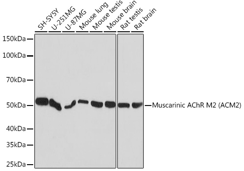 Western blot analysis of various lysates using Muscarinic AChR M2 (Muscarinic AChR M2) Rabbit mAb at 1:1000 dilution.|Secondary antibody: HRP-conjugated Goat anti-Rabbit IgG (H+L) at 1:10000 dilution.|Lysates/proteins: 25μg per lane.|Blocking buffer: 3% nonfat dry milk in TBST.|Detection: ECL Basic Kit.|Exposure time: 10s.
