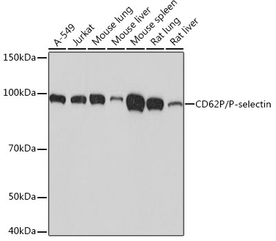 Western blot analysis of various lysates using CD62P/P-selectin Rabbit mAb at 1:1000 dilution.|Secondary antibody: HRP-conjugated Goat anti-Rabbit IgG (H+L) at 1:10000 dilution.|Lysates/proteins: 25μg per lane.|Blocking buffer: 3% nonfat dry milk in TBST.|Detection: ECL Basic Kit.|Exposure time: 10s.