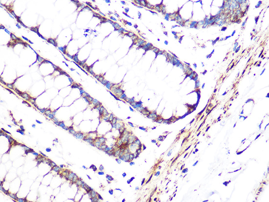 Immunohistochemistry analysis of paraffin-embedded Human colon using FHL1 Rabbit mAb at dilution of 1:100 (40x lens). Microwave antigen retrieval performed with 0.01M Tris/EDTA Buffer (pH 9.0) prior to IHC staining.