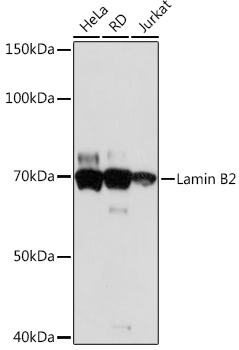 Western blot analysis of various lysates using Lamin B2 Rabbit mAb at 1:1000 dilution.|Secondary antibody: HRP-conjugated Goat anti-Rabbit IgG (H+L) at 1:10000 dilution.|Lysates/proteins: 25μg per lane.|Blocking buffer: 3% nonfat dry milk in TBST.|Detection: ECL Basic Kit.|Exposure time: 30s.