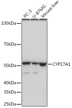 Western blot analysis of various lysates using CYP17A1 Rabbit mAb at 1:1000 dilution.|Secondary antibody: HRP-conjugated Goat anti-Rabbit IgG (H+L) at 1:10000 dilution.|Lysates/proteins: 25μg per lane.|Blocking buffer: 3% nonfat dry milk in TBST.|Detection: ECL Basic Kit.|Exposure time: 3s.