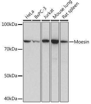 Western blot analysis of various lysates using Moesin Rabbit mAb at 1:1000 dilution.|Secondary antibody: HRP-conjugated Goat anti-Rabbit IgG (H+L) at 1:10000 dilution.|Lysates/proteins: 25μg per lane.|Blocking buffer: 3% nonfat dry milk in TBST.|Detection: ECL Basic Kit.|Exposure time: 1s.