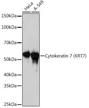 Western blot analysis of various lysates using Cytokeratin 7 (KRT7) (KRT7)  Rabbit mAb at 1:1000 dilution.|Secondary antibody: HRP-conjugated Goat anti-Rabbit IgG (H+L) at 1:10000 dilution.|Lysates/proteins: 25μg per lane.|Blocking buffer: 3% nonfat dry milk in TBST.|Detection: ECL Basic Kit.|Exposure time: 10s.