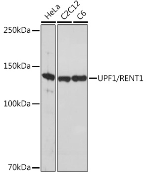 Western blot analysis of various lysates using UPF1/RENT1 Rabbit mAb at 1:1000 dilution.|Secondary antibody: HRP-conjugated Goat anti-Rabbit IgG (H+L) at 1:10000 dilution.|Lysates/proteins: 25μg per lane.|Blocking buffer: 3% nonfat dry milk in TBST.|Detection: ECL Basic Kit.|Exposure time: 10s.