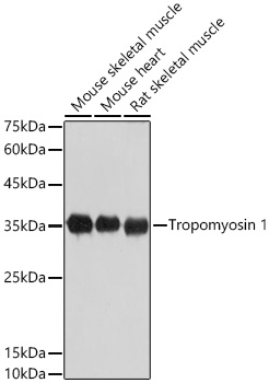 Western blot analysis of various lysates using Tropomyosin 1 Rabbit mAb at 1:1000 dilution incubated overnight at 4℃.|Secondary antibody: HRP-conjugated Goat anti-Rabbit IgG (H+L) at 1:10000 dilution.|Lysates/proteins: 25 μg per lane.|Blocking buffer: 3% nonfat dry milk in TBST.|Detection: ECL Basic Kit.|Exposure time: 5 s.