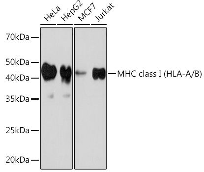 Western blot analysis of various lysates using MHC class I (HLA-A/B) Rabbit mAb at 1:1000 dilution.|Secondary antibody: HRP-conjugated Goat anti-Rabbit IgG (H+L) at 1:10000 dilution.|Lysates/proteins: 25μg per lane.|Blocking buffer: 3% nonfat dry milk in TBST.|Detection: ECL Basic Kit.|Exposure time: 90s.