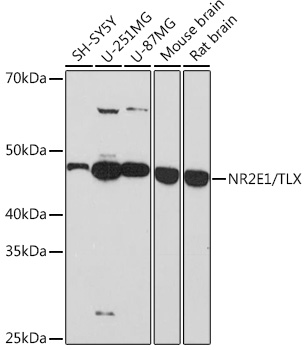 Western blot analysis of various lysates using NR2E1/TLX Rabbit mAb at 1:1000 dilution.|Secondary antibody: HRP-conjugated Goat anti-Rabbit IgG (H+L) at 1:10000 dilution.|Lysates/proteins: 25μg per lane.|Blocking buffer: 3% nonfat dry milk in TBST.|Detection: ECL Basic Kit.|Exposure time: 3min.
