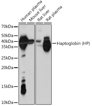 Western blot analysis of various lysates using Haptoglobin (HP) (HP) Rabbit mAb at 1:1000 dilution.|Secondary antibody: HRP-conjugated Goat anti-Rabbit IgG (H+L) at 1:10000 dilution.|Lysates/proteins: 25μg per lane.|Blocking buffer: 3% nonfat dry milk in TBST.|Detection: ECL Enhanced Kit.|Exposure time: 10s.