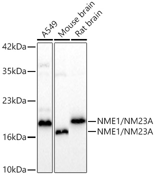 Western blot analysis of various lysates using NME1/NM23A Rabbit mAb at 1:1000 dilution incubated overnight at 4℃.|Secondary antibody: HRP-conjugated Goat anti-Rabbit IgG (H+L) at 1:10000 dilution.|Lysates/proteins: 25 μg per lane.|Blocking buffer: 3% nonfat dry milk in TBST.|Detection: ECL Basic Kit.|Exposure time: 20 s.