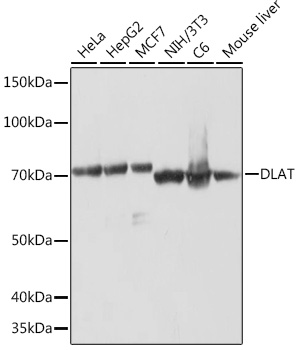 Western blot analysis of various lysates using DLAT Rabbit mAb at 1:1000 dilution.|Secondary antibody: HRP-conjugated Goat anti-Rabbit IgG (H+L) at 1:10000 dilution.|Lysates/proteins: 25μg per lane.|Blocking buffer: 3% nonfat dry milk in TBST.|Detection: ECL Basic Kit.|Exposure time: 1min.