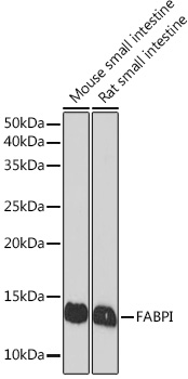 Western blot analysis of various lysates using FABPI Rabbit mAb at 1:1000 dilution.|Secondary antibody: HRP-conjugated Goat anti-Rabbit IgG (H+L) at 1:10000 dilution.|Lysates/proteins: 25μg per lane.|Blocking buffer: 3% nonfat dry milk in TBST.|Detection: ECL Basic Kit.|Exposure time: 60s.
