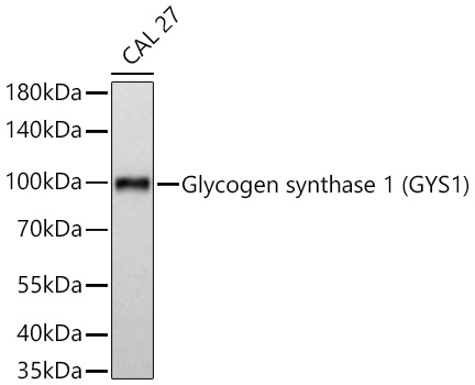 Western blot analysis of lysates from CAL 27 cells using Glycogen synthase 1 (GYS1) Rabbit mAb at 1:1000 dilution incubated overnight at 4℃.|Secondary antibody: HRP-conjugated Goat anti-Rabbit IgG (H+L) at 1:10000 dilution.|Lysates/proteins: 25 μg per lane.|Blocking buffer: 3% nonfat dry milk in TBST.|Detection: ECL Basic Kit.|Exposure time: 45 s.