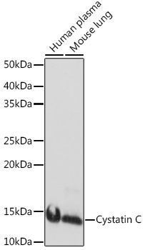 Western blot analysis of various lysates using Cystatin C Rabbit mAb at 1:1000 dilution.|Secondary antibody: HRP-conjugated Goat anti-Rabbit IgG (H+L) at 1:10000 dilution.|Lysates/proteins: 25μg per lane.|Blocking buffer: 3% nonfat dry milk in TBST.|Detection: ECL Basic Kit.|Exposure time: 1s.
