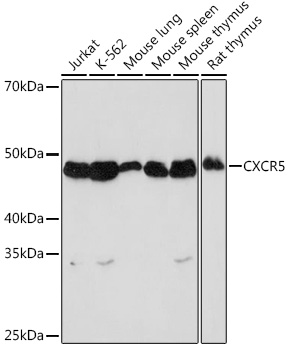 Western blot analysis of various lysates using CXCR5 Rabbit mAb at 1:1000 dilution.|Secondary antibody: HRP-conjugated Goat anti-Rabbit IgG (H+L) at 1:10000 dilution.|Lysates/proteins: 25μg per lane.|Blocking buffer: 3% nonfat dry milk in TBST.|Detection: ECL Basic Kit.|Exposure time: 90s.