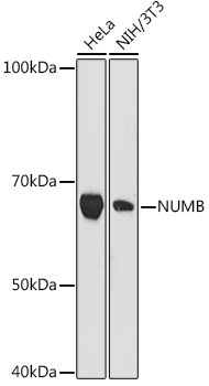 Western blot analysis of various lysates using NUMB Rabbit mAb at 1:1000 dilution.|Secondary antibody: HRP-conjugated Goat anti-Rabbit IgG (H+L) at 1:10000 dilution.|Lysates/proteins: 25μg per lane.|Blocking buffer: 3% nonfat dry milk in TBST.|Detection: ECL Basic Kit.|Exposure time: 180s.