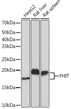 Western blot analysis of various lysates using FHIT Rabbit mAb at 1:1000 dilution.|Secondary antibody: HRP-conjugated Goat anti-Rabbit IgG (H+L) at 1:10000 dilution.|Lysates/proteins: 25μg per lane.|Blocking buffer: 3% nonfat dry milk in TBST.|Detection: ECL Basic Kit.|Exposure time: 60s.