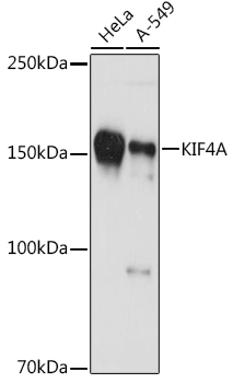 Western blot analysis of various lysates using KIF4A Rabbit mAb at 1:1000 dilution.|Secondary antibody: HRP-conjugated Goat anti-Rabbit IgG (H+L) at 1:10000 dilution.|Lysates/proteins: 25μg per lane.|Blocking buffer: 3% nonfat dry milk in TBST.|Detection: ECL Basic Kit.|Exposure time: 60s.