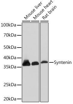 Western blot analysis of various lysates using Syntenin Rabbit mAb at 1:1000 dilution.|Secondary antibody: HRP-conjugated Goat anti-Rabbit IgG (H+L) at 1:10000 dilution.|Lysates/proteins: 25μg per lane.|Blocking buffer: 3% nonfat dry milk in TBST.|Detection: ECL Basic Kit.|Exposure time: 3min.