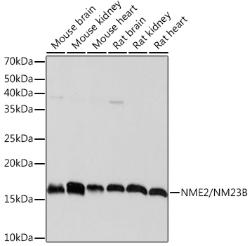 Western blot analysis of various lysates, using NME2/NM23B Rabbit mAb at 1:1000 dilution.|Secondary antibody: HRP-conjugated Goat anti-Rabbit IgG (H+L) at 1:10000 dilution.|Lysates/proteins: 25μg  per lane.|Blocking buffer: 3% nonfat dry milk in TBST.|Detection: ECL Basic Kit.|Exposure time: 1s.