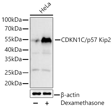 Western blot analysis of lysates from HeLa cells using CDKN1C/p57 Kip2 Rabbit mAb at 1:2000 dilution incubated overnight at 4℃. HeLa cells were treated with Dexamethasone (500 nM) at 37℃ for 16hrs .|Secondary antibody: HRP-conjugated Goat anti-Rabbit IgG (H+L) at 1:10000 dilution.|Lysates/proteins: 25 μg per lane.| Blocking buffer: 3 % nonfat dry milk in TBST.| Detection: ECL Basic Kit.| Exposure time: 10s.