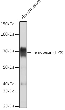 Western blot analysis of lysates from Human serum, using Hemopexin (HPX) (HPX) Rabbit mAb at 1:5000 dilution.|Secondary antibody: HRP-conjugated Goat anti-Rabbit IgG (H+L) at 1:10000 dilution.|Lysates/proteins: 25μg per lane.|Blocking buffer: 3% nonfat dry milk in TBST.|Detection: ECL Basic Kit.|Exposure time: 1s.