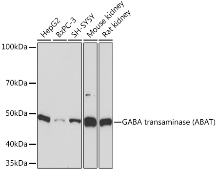 Western blot analysis of various lysates using GABA transaminase (GABA transaminase) Rabbit mAb at 1:1000 dilution.|Secondary antibody: HRP-conjugated Goat anti-Rabbit IgG (H+L) at 1:10000 dilution.|Lysates/proteins: 25μg per lane.|Blocking buffer: 3% nonfat dry milk in TBST.|Detection: ECL Basic Kit.|Exposure time: 10s.