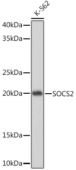 Western blot analysis of lysates from K-562 cells, using SOCS2 Rabbit mAb at 1:1000 dilution.|Secondary antibody: HRP-conjugated Goat anti-Rabbit IgG (H+L) at 1:10000 dilution.|Lysates/proteins: 25μg per lane.|Blocking buffer: 3% nonfat dry milk in TBST.|Detection: ECL Basic Kit.|Exposure time: 1s.