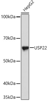 Western blot analysis of lysates from HepG2 cells, using USP22 Rabbit mAb at 1:1000 dilution.|Secondary antibody: HRP-conjugated Goat anti-Rabbit IgG (H+L) at 1:10000 dilution.|Lysates/proteins: 25μg per lane.|Blocking buffer: 3% nonfat dry milk in TBST.|Detection: ECL Basic Kit.|Exposure time: 1s.