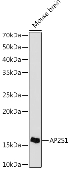 Western blot analysis of lysates from Mouse brain , using AP2S1 Rabbit mAb at 1:1000 dilution.|Secondary antibody: HRP-conjugated Goat anti-Rabbit IgG (H+L) at 1:10000 dilution.|Lysates/proteins: 25μg per lane.|Blocking buffer: 3% nonfat dry milk in TBST.|Detection: ECL Basic Kit.|Exposure time: 30s.