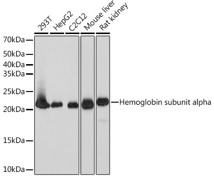 Western blot analysis of various lysates using DHFR  Rabbit mAb at 1:1000 dilution.|Secondary antibody: HRP-conjugated Goat anti-Rabbit IgG (H+L) at 1:10000 dilution.|Lysates/proteins: 25μg per lane.|Blocking buffer: 3% nonfat dry milk in TBST.|Detection: ECL Basic Kit.|Exposure time: 3s.