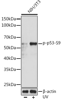 Western blot analysis of lysates from NIH/3T3 cells, using Phospho-p53-S9 Rabbit mAb at 1:1000 dilution. NIH/3T3 cells were treated with UV at room temperature for 15-30 minutes.|Secondary antibody: HRP-conjugated Goat anti-Rabbit IgG (H+L) at 1:10000 dilution.|Lysates/proteins: 25μg per lane.|Blocking buffer: 3% BSA.|Detection: ECL Enhanced Kit.|Exposure time: 3min.