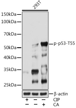 Western blot analysis of lysates from 293T cells, using Phospho-p53-T55 Rabbit mAb at 1:1000 dilution. 293T cells were treated with CIP(20uL/400ul) at 37℃ for 1 hour or treated with Calyculin A (100 nM) at 37℃ for 30 minutes after serum-starvation overnight.|Secondary antibody: HRP-conjugated Goat anti-Rabbit IgG (H+L) at 1:10000 dilution.|Lysates/proteins: 25μg per lane.|Blocking buffer: 3% BSA.|Detection: ECL Basic Kit.|Exposure time: 30s.