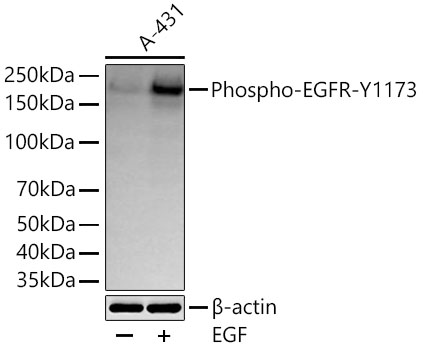 Western blot analysis of lysates from A-431 cells using Phospho-EGFR-Y1173 Rabbit mAb at 1:1000 dilution incubated at room temperature for 1.5 hours. A-431 cells were treated with EGF (100 ng/mL) at 37℃ for 30 minutes after serum-starvation overnight.|Secondary antibody: HRP-conjugated Goat anti-Rabbit IgG (H+L) at 1:10000 dilution.|Lysates/proteins: 30 μg per lane.| Blocking buffer: 3% nonfat dry milk in TBST.| Detection: ECL Basic Kit.| Exposure time: 45s.