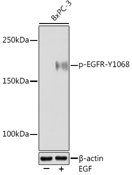 Western blot analysis of lysates from BxPC-3 cells, using Phospho-EGFR-Y1068 Rabbit mAb at 1:1000 dilution. BxPC-3 cells were treated with EGF (100 ng/mL) at 37℃ for 30 minutes after serum-starvation overnight.|Secondary antibody: HRP-conjugated Goat anti-Rabbit IgG (H+L) at 1:10000 dilution.|Lysates/proteins: 25μg per lane.|Blocking buffer: 3% BSA.|Detection: ECL Enhanced Kit.|Exposure time: 3min.