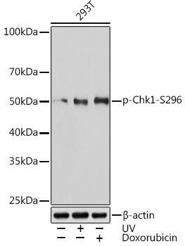 Western blot analysis of lysates from 293T cells, using Phospho-Chk1-S296 Rabbit mAb at 1:1000 dilution. 293T cells were treated with UV at room temperature for 15-30 minutes and Doxorubicin (0. 5 uM) at 37℃ for 24 hours.|Secondary antibody: HRP-conjugated Goat anti-Rabbit IgG (H+L) at 1:10000 dilution.|Lysates/proteins: 25μg per lane.|Blocking buffer: 3% BSA.|Detection: ECL Basic Kit.|Exposure time: 3min.