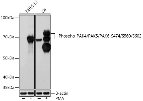 Western blot analysis of various lysates using Phospho-PAK4/PAK5/PAK6-S474/S560/S602 Rabbit mAb at 1:1000 dilution. Both NIH/3T3 cells and C6 cells were treated with PMA/TPA (200 nM) at 37℃ for 30 minutes after serum-starvation overnight.|Secondary antibody: HRP-conjugated Goat anti-Rabbit IgG (H+L) at 1:10000 dilution.|Lysates/proteins: 25μg per lane.|Blocking buffer: 3% BSA.|Detection: ECL Basic Kit.|Exposure time: 10s.