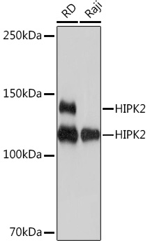 Western blot analysis of various lysates using HIPK2 Rabbit mAb at 1:1000 dilution.|Secondary antibody: HRP-conjugated Goat anti-Rabbit IgG (H+L) at 1:10000 dilution.|Lysates/proteins: 25μg per lane.|Blocking buffer: 3% nonfat dry milk in TBST.|Detection: ECL Basic Kit.|Exposure time: 1s.