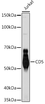 Western blot analysis of lysates from Jurkat cells, using CD5 Rabbit mAb at 1:1000 dilution.|Secondary antibody: HRP-conjugated Goat anti-Rabbit IgG (H+L) at 1:10000 dilution.|Lysates/proteins: 25μg per lane.|Blocking buffer: 3% nonfat dry milk in TBST.|Detection: ECL Basic Kit.|Exposure time: 30s.