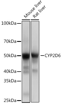 Western blot analysis of various lysates using CYP2D6 Rabbit mAb at 1:1000 dilution incubated overnight at 4℃.|Secondary antibody: HRP-conjugated Goat anti-Rabbit IgG (H+L) at 1:10000 dilution.|Lysates/proteins: 25 μg per lane.|Blocking buffer: 3% nonfat dry milk in TBST.|Detection: ECL Basic Kit.|Exposure time: 1s.